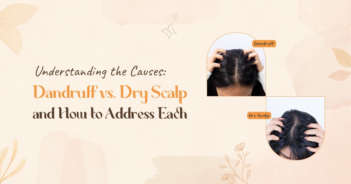 Dandruff vs. Dry Scalp